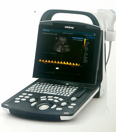 ultrasound machine prices in nigeria