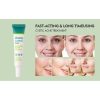 Tube of Advanced Acne Solution-ACNE Face Cream for spot treatment and acne care, lightweight anti-acne formula sold by Elomart in Nigeria